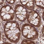 BITE Antibody in Immunohistochemistry (IHC)