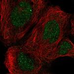 RAI14 Antibody in Immunocytochemistry (ICC/IF)