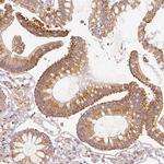 PGAM5 Antibody in Immunohistochemistry (IHC)