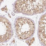 PGAM5 Antibody in Immunohistochemistry (IHC)