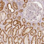 PGAM5 Antibody in Immunohistochemistry (IHC)