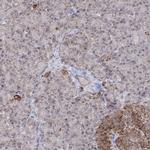 GRSF1 Antibody in Immunohistochemistry (IHC)