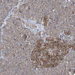 GRSF1 Antibody in Immunohistochemistry (IHC)