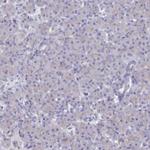 ASTE1 Antibody in Immunohistochemistry (IHC)