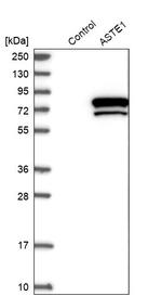 ASTE1 Antibody in Western Blot (WB)