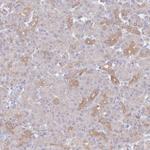 ASTE1 Antibody in Immunohistochemistry (IHC)