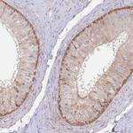 ASTE1 Antibody in Immunohistochemistry (IHC)