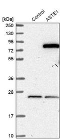 ASTE1 Antibody in Western Blot (WB)