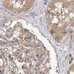 WDR37 Antibody in Immunohistochemistry (IHC)