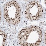 SKIV2L2 Antibody in Immunohistochemistry (IHC)