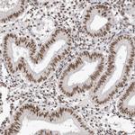 SKIV2L2 Antibody in Immunohistochemistry (IHC)