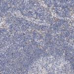 AGXT2 Antibody in Immunohistochemistry (IHC)