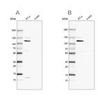 MCC Antibody in Western Blot (WB)