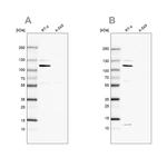 MCC Antibody in Western Blot (WB)