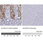 SLC6A19 Antibody in Immunohistochemistry (IHC)