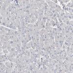 DNAH5 Antibody in Immunohistochemistry (IHC)