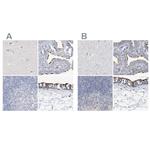 DNAH5 Antibody in Immunohistochemistry (IHC)