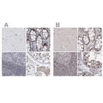 RAP80 Antibody in Immunohistochemistry (IHC)