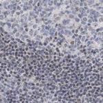 RAP80 Antibody in Immunohistochemistry (IHC)