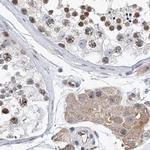 RAP80 Antibody in Immunohistochemistry (IHC)