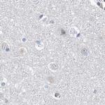 RAP80 Antibody in Immunohistochemistry (IHC)