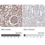 DDO Antibody in Immunohistochemistry (IHC)