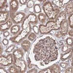 DDO Antibody in Immunohistochemistry (IHC)