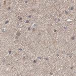 DDO Antibody in Immunohistochemistry (IHC)