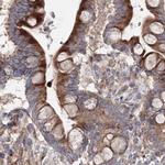 DDO Antibody in Immunohistochemistry (IHC)