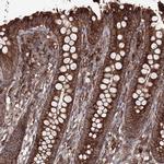 DDO Antibody in Immunohistochemistry (IHC)