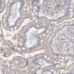 SH3BP4 Antibody in Immunohistochemistry (IHC)