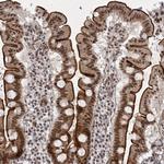 SR140 Antibody in Immunohistochemistry (IHC)