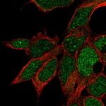 RPUSD3 Antibody in Immunocytochemistry (ICC/IF)