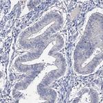 EPB41L5 Antibody in Immunohistochemistry (IHC)