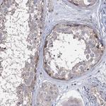 EPB41L5 Antibody in Immunohistochemistry (IHC)