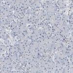 RPP30 Antibody in Immunohistochemistry (IHC)