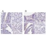 Enkurin Antibody in Immunohistochemistry (IHC)