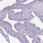 Enkurin Antibody in Immunohistochemistry (IHC)