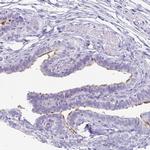 Enkurin Antibody in Immunohistochemistry (IHC)