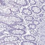 Enkurin Antibody in Immunohistochemistry (IHC)