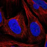 CEP164 Antibody in Immunocytochemistry (ICC/IF)