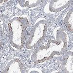 CEP164 Antibody in Immunohistochemistry (IHC)