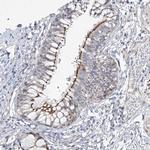 CEP164 Antibody in Immunohistochemistry (IHC)