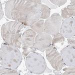 CEP164 Antibody in Immunohistochemistry (IHC)