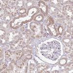 CEP164 Antibody in Immunohistochemistry (IHC)