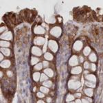 FCHO2 Antibody in Immunohistochemistry (IHC)