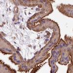 FCHO2 Antibody in Immunohistochemistry (IHC)