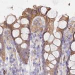 FCHO2 Antibody in Immunohistochemistry (IHC)