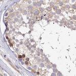 FCHO2 Antibody in Immunohistochemistry (IHC)