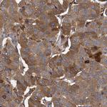 BCS1L Antibody in Immunohistochemistry (IHC)